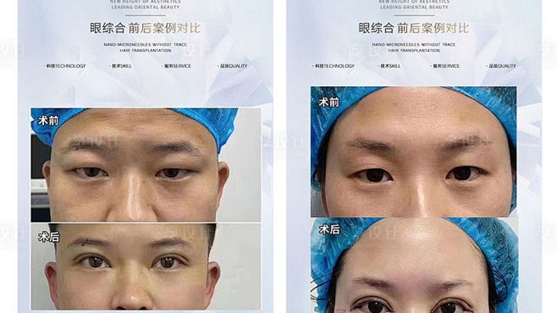 成都面部抗衰美容，揭秘价格背后的真相