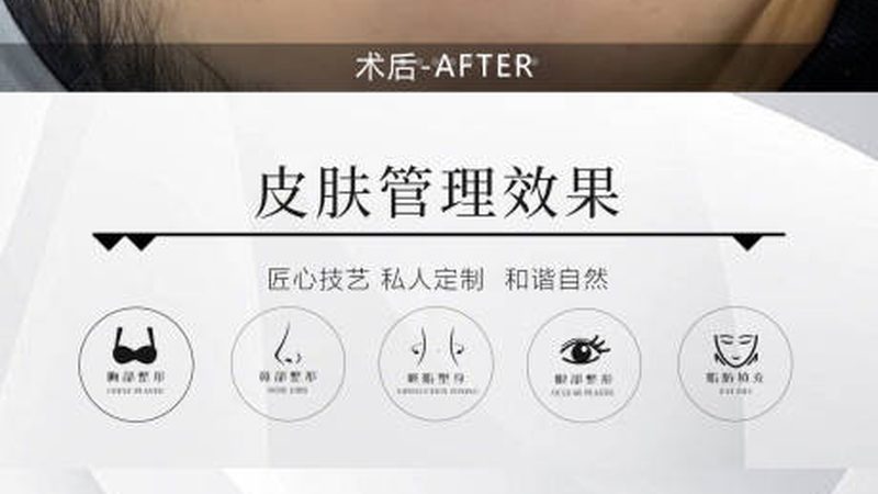 开内眼角与双眼皮，哪种更适合你？**