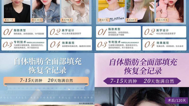 隆鼻失败？揭秘隆鼻假体取出背后的真相
