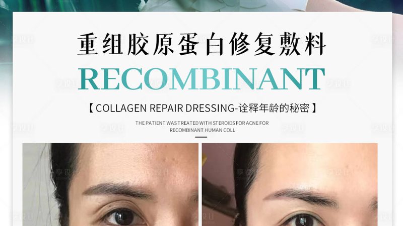 医美注射材料大揭秘：分类与区别全解析**