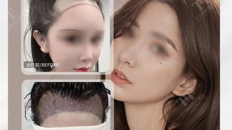 皮肤管理中心美团点评运营技巧