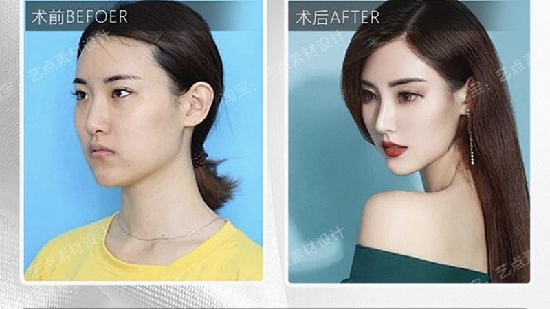 家用光子嫩肤仪代理渠道：揭秘行业“幕后