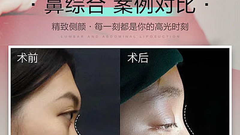 轻医美护肤产品规格参数