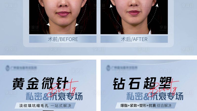 全身吸脂的费用里藏着哪些隐形门槛
