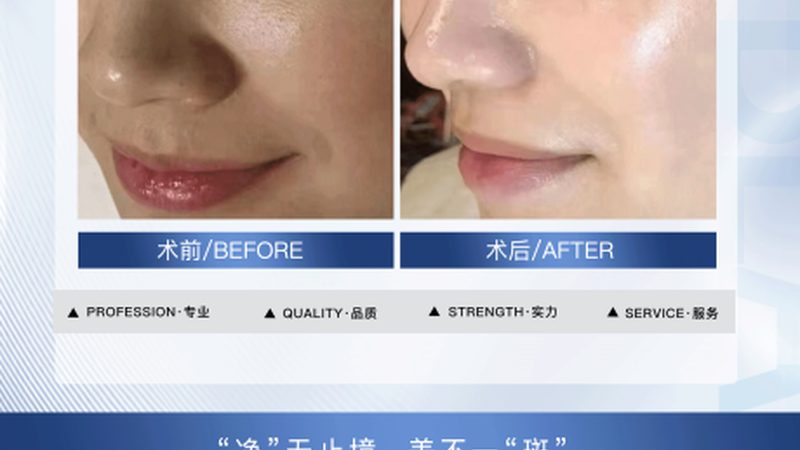 医美咨询师培训教材：从入门到精通的必读指南