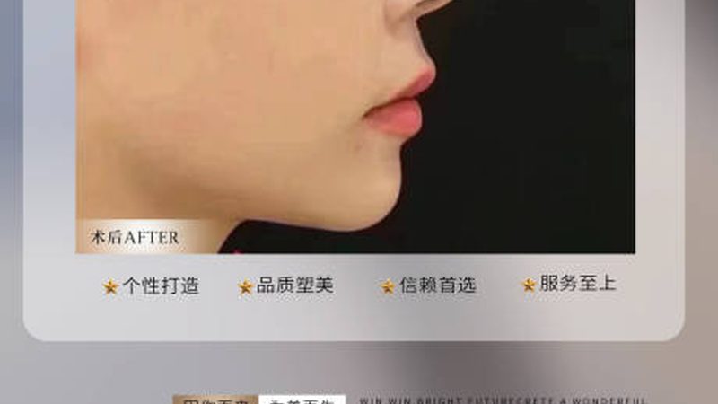青岛注射微整医生排名前十