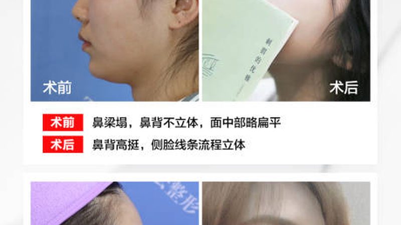 美容院激光脱毛设备安装步骤