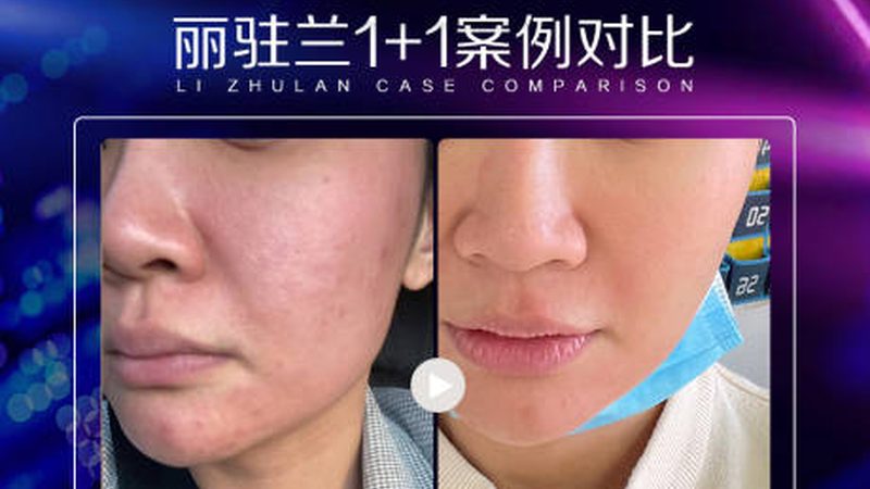 小标题：抗衰精华液的成分解析