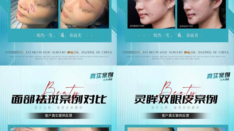 上海激光美容医院收费标准揭秘：看懂这些，消费更明智**