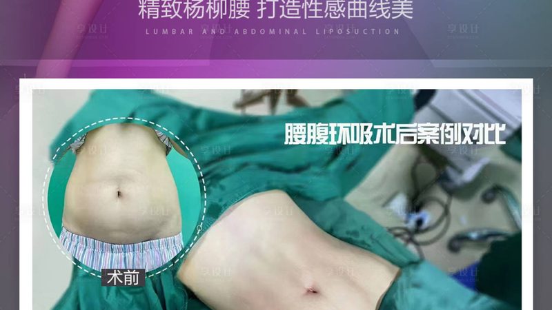 眼部整形：全麻与局麻，哪种更适合你？**