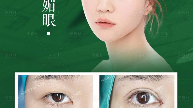 韩式三点双眼皮，揭秘价格背后的秘密**