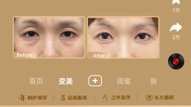 小标题：蛋白线提升的效果原理