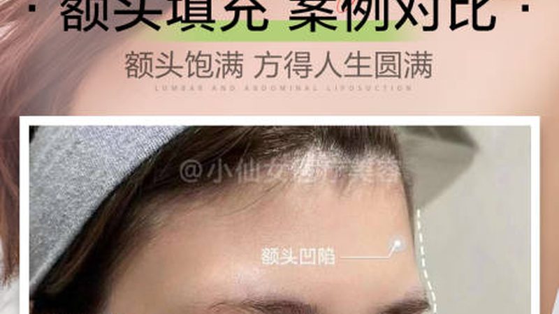 皮肤管理仪器定制流程揭秘：关键步骤与注意事项